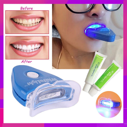 Tooth Whitening System – Advanced Teeth Whitening Kit for a Brighter Smile